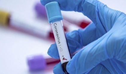 1123 нови случая на коронавирус за денонощие у нас
